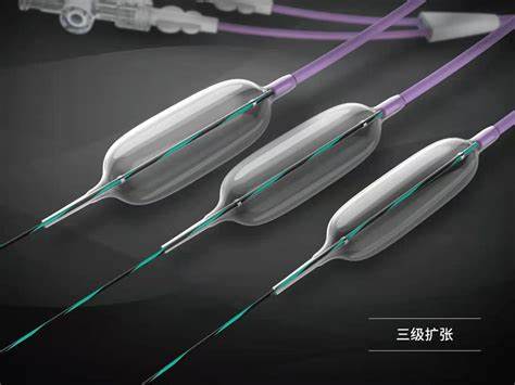 球囊导管